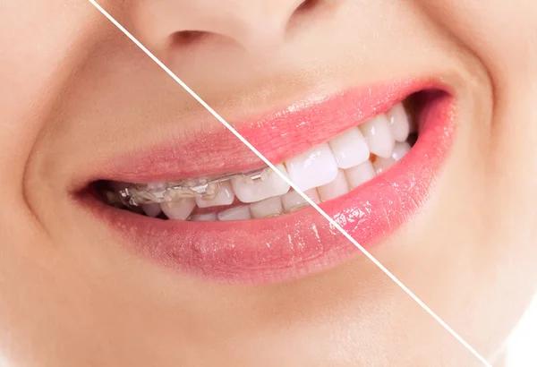 Thrive Dental and Orthodontics Dallas for Confident Smiles